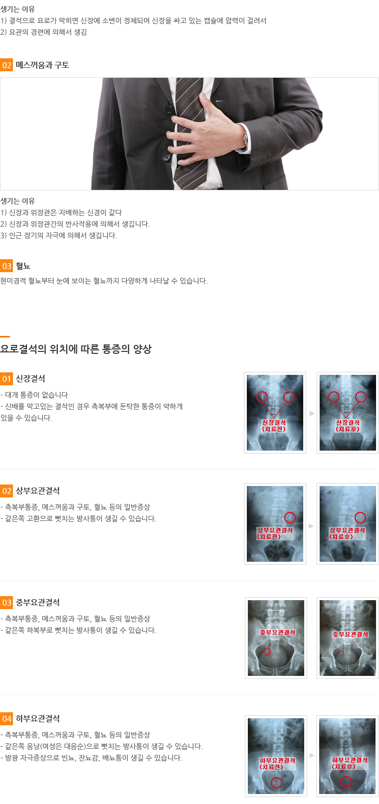 증상