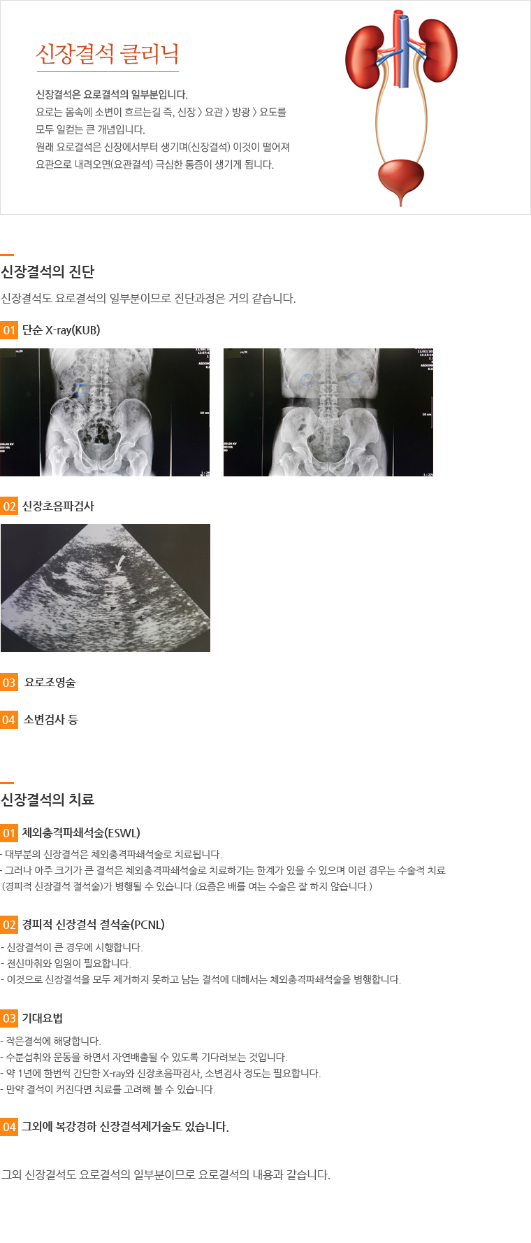 신장결석