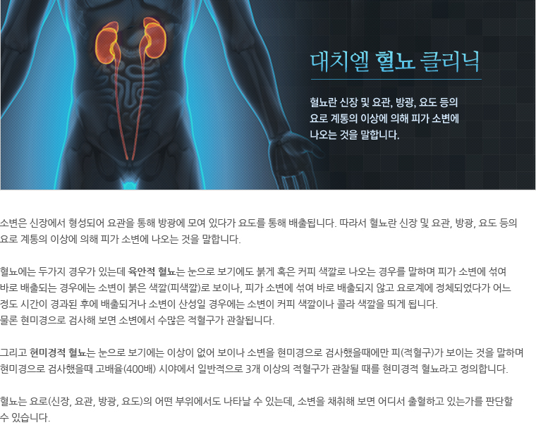 대치엘